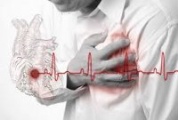 Miokard infarktının simptomları və diaqnostikası