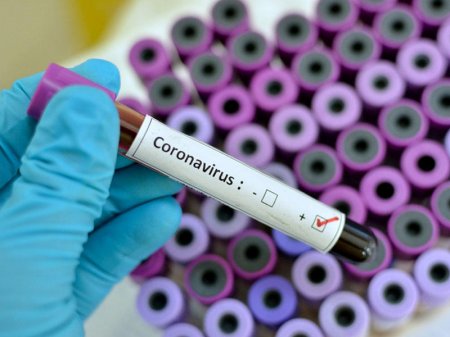 Yapon həkimdən DÜNYAYA ÜMİD İŞIĞI:  Koronavirusa qarşı YENİ METOD