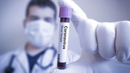 Azərbaycanda 10 yeni koronavirusa yoluxma faktı qeydə alındı