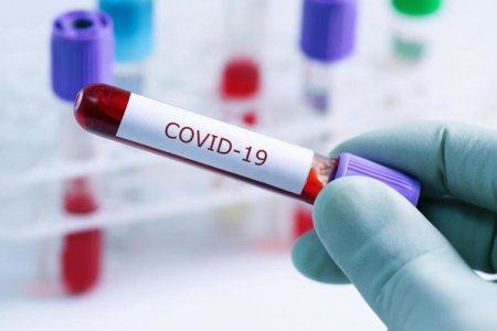 Azərbaycanda daha 43 nəfər koronavirusa yoluxdu