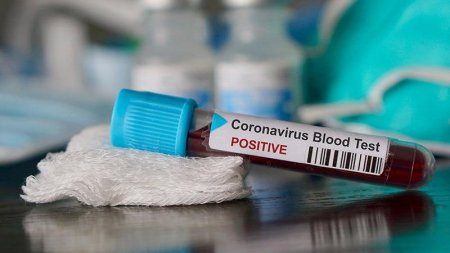 Azərbaycanda daha 165 nəfər koronavirusa yoluxub