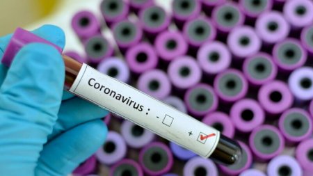 Azərbaycanda daha 559 nəfər koronavirusa yoluxdu, 7 nəfər öldü