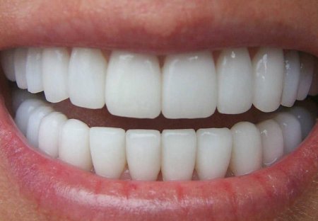 Dişlər yaddaş funksiyasına təsir edir...