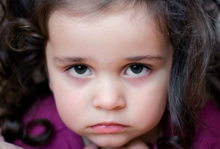 Uşaqların gözlərinin altı niyə qaralır? 8 ən yayılmış səbəb
