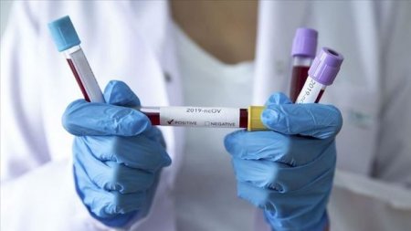 Azərbaycanda daha 32 nəfər koronavirusdan öldü: 4212 yeni yoluxma