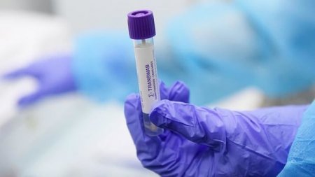 Azərbaycanda daha 12 nəfər koronavirusdan öldü: 349 yeni yoluxma