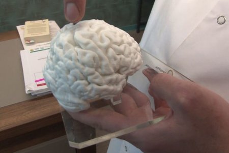 Türkiyədə bir ilk: 3D printerlə insan beyninin nüsxəsi hazırlandı 