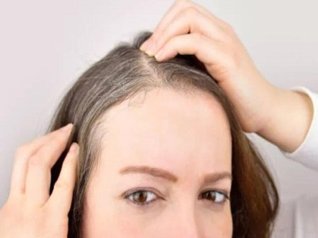 Erkən yaşda saç ağarmasının qarşısını almağın 4 YOLU