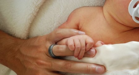 TİBB DÜNYASI ŞOKDA: Beyni burnunda yerləşən uşaq doğulub – FOTO