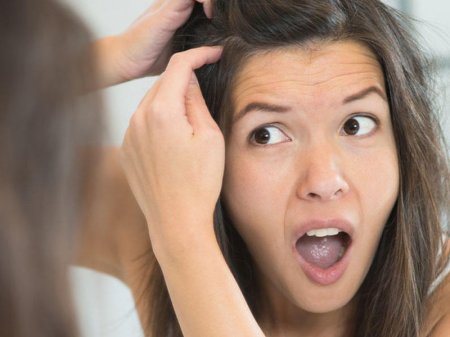 Saçların erkən ağarmasının səbəbləri