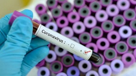 “Koronavirusa qarşı peyvənd hazırlanmayacaq...” - Avstraliyalı alimdən ŞOK AÇIQLAMA