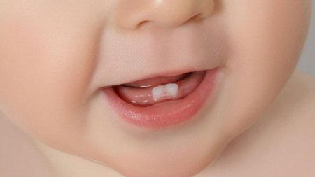 İlk dişlərin çıxmasının problemləri