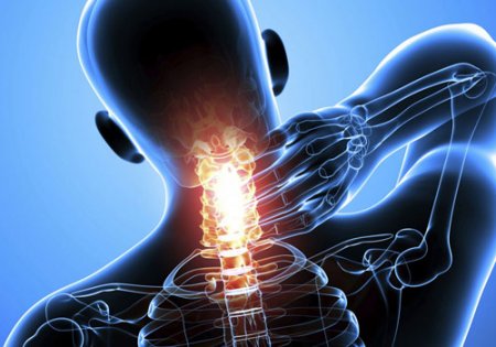 Boyun ağrılarının səbəbləri
