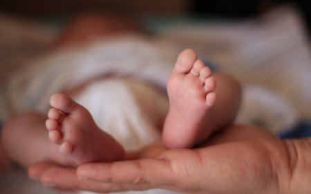 İkibaşlı uşaq doğuldu - FOTO