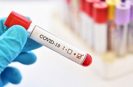 Koronavirus insandan insana keçmir? - Böyük yalan ortaya çıxdı!