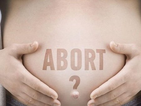 14-17 yaşlı qızlar arasında ABORT sayı niyə artıb? - “Onlar ana olmaya bilərlər”