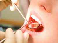 Diş həkimi ağız qoxusunun əsas səbəblərini AÇIQLADI