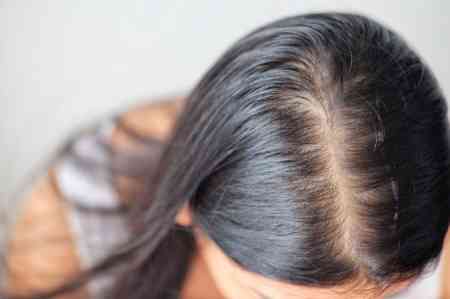Hansı vitamin çatışmazlığı saç tökülməsinə səbəb olur?